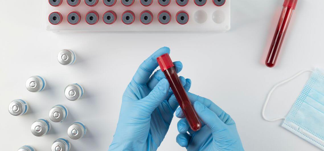 Vacuum Blood Collection Tubes